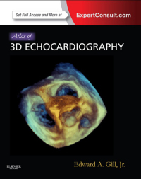 Immagine di copertina: Atlas of 3D Echocardiography 9781437726992