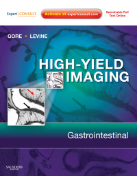 Cover image: High Yield Imaging: Gastrointestinal - Electronic 1st edition 9781416055440