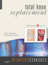 Cover image: Operative Techniques: Total Knee Replacement - Electronic 1st edition 9781416049845