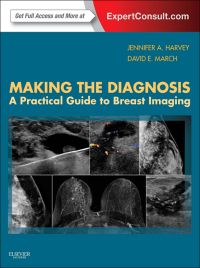 صورة الغلاف: Making the Diagnosis: A Practical Guide to Breast Imaging 9781455722846