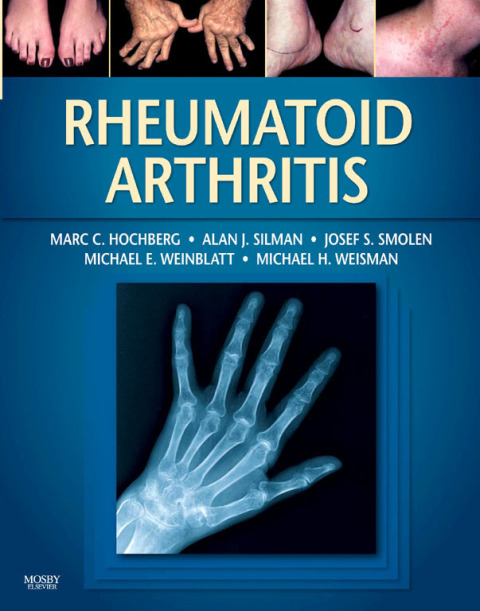 Rheumatoid Arthritis - Electronic, 1st Edition - FULL INSTANT DOWNLOAD | PDF DOCX EPUB
