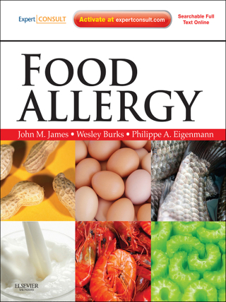 Imagen de portada: Food Allergy 9781437719925
