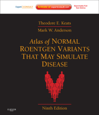 Imagen de portada: Atlas of Normal Roentgen Variants That May Simulate Disease E-Book 9th edition 9780323073554