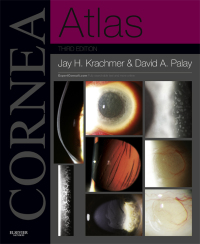 Titelbild: Cornea Atlas 3rd edition 9781455740604