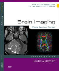 Titelbild: Brain Imaging: Case Review Series 2nd edition 9780323031790