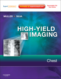 صورة الغلاف: High-Yield Imaging: Chest - Electronic 1st edition 9781416061618