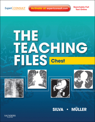 Cover image: The Teaching Files: Chest - Electronic 1st edition 9781416061106