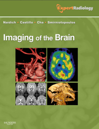 Cover image: Imaging of the Brain - Electronic 1st edition 9781416050094