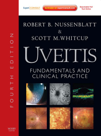 Cover image: Uveitis - Electronic 4th edition 9781437706673