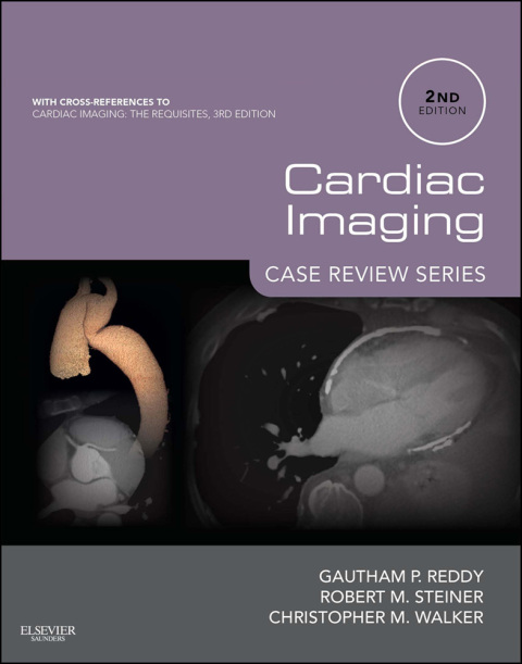 Cardiac Imaging: Case Review Series, 2nd Edition - FULL INSTANT DOWNLOAD | PDF DOCX EPUB