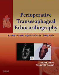 Cover image: Perioperative Transesophageal Echocardiography 9781455707614