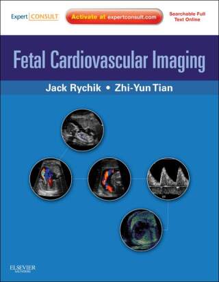Imagen de portada: Fetal Cardiovascular Imaging: A Disease Based Approach 9781416031727