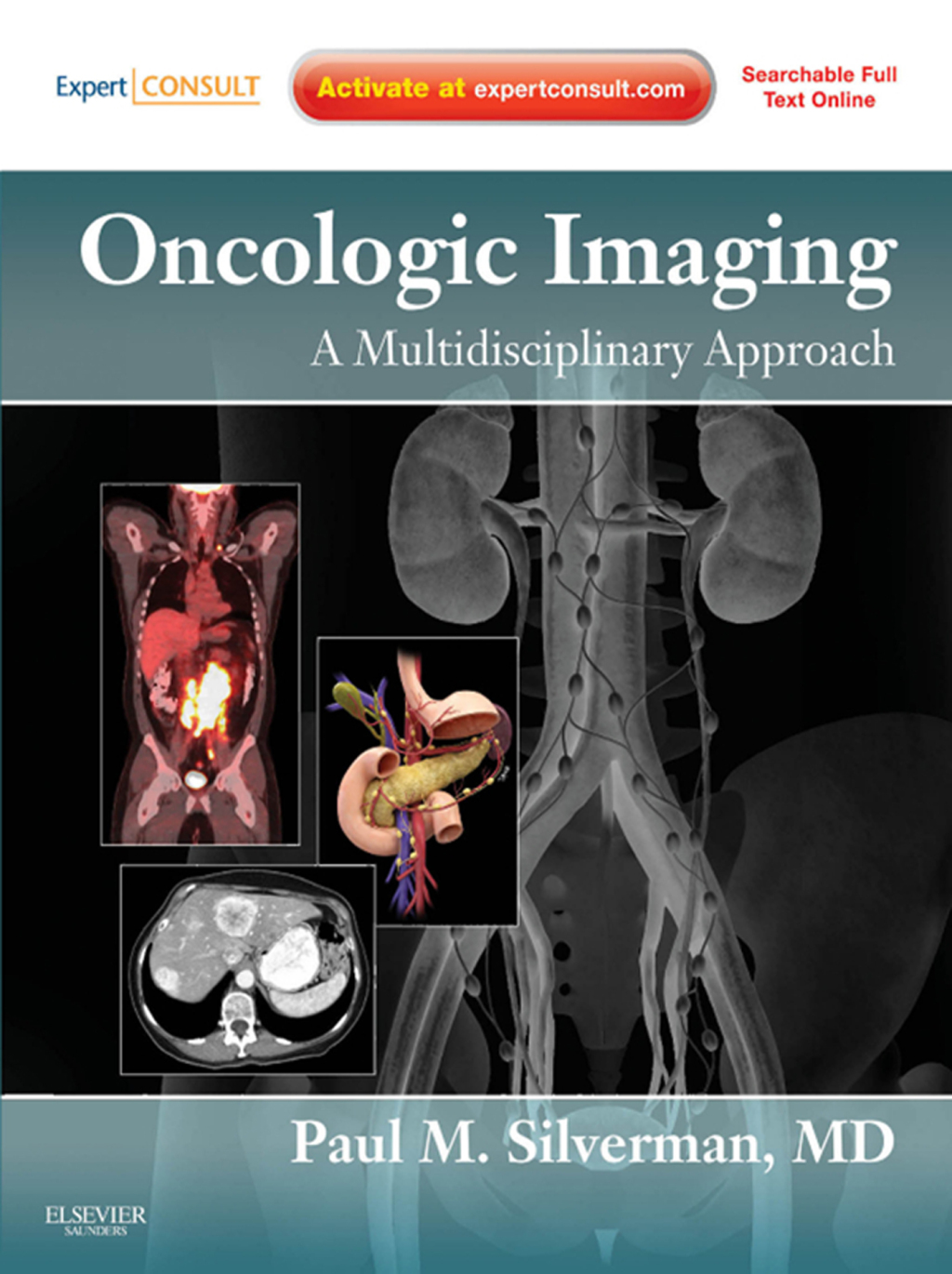 Oncologic Imaging: A Multidisciplinary Approach 1st Edition
    Newer Edition Available
