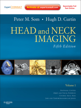 Immagine di copertina: Head and Neck Imaging 5th edition 9780323053556