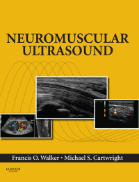 Cover image: Neuromuscular Ultrasound 9781437715279