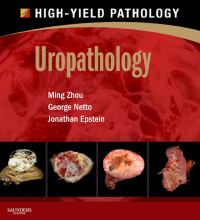 Titelbild: Uropathology 9781437725230