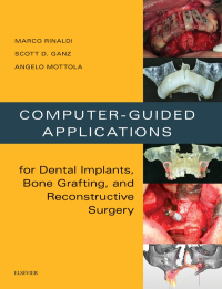 Cover image: Computer-Guided Dental Implants and Reconstructive Surgery 9780323278034