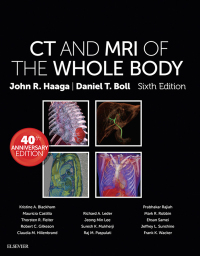 Cover image: CT and MRI of the Whole Body - Electronic 6th edition 9780323113281