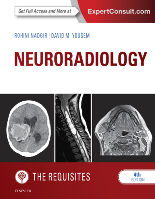 Imagen de portada: Neuroradiology: The Requisites 4th edition 9781455775682