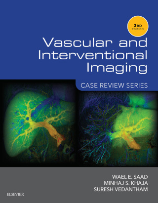 Immagine di copertina: Vascular and Interventional Imaging: Case Review Series 3rd edition 9781455776306