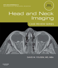 Immagine di copertina: Head and Neck Imaging: Case Review Series 4th edition 9781455776290