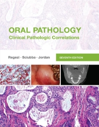 Cover image: Oral Pathology: Clinical Pathologic Correlations 7th edition 9780323297684
