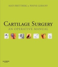 Cover image: Cartilage Surgery E-Book 9781437708783