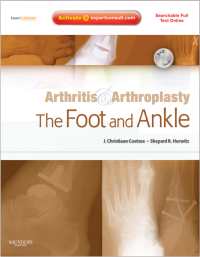 Cover image: Arthritis and Arthroplasty: The Foot and Ankle - Electronic 1st edition 9781416049722