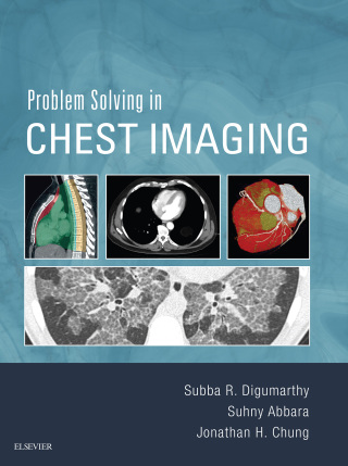 Cover image: Problem Solving in Chest Imaging 9780323041324