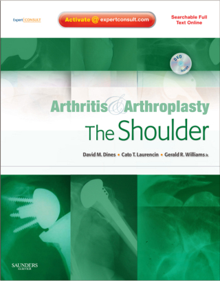 Cover image: Arthritis and Arthroplasty: The Shoulder - Electronic 1st edition 9781416049753