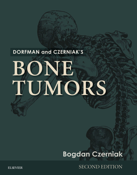 Dorfman and Czerniak’s Bone Tumors, 2nd Edition - FULL INSTANT DOWNLOAD | PDF DOCX EPUB