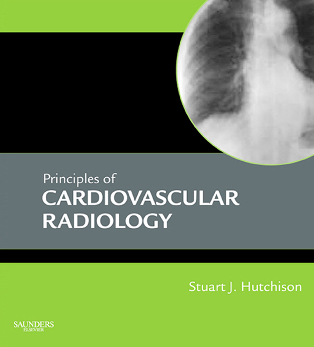 Principles of Cardiovascular Radiology 1st Edition