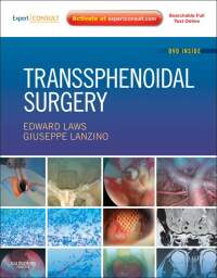 Cover image: Transsphenoidal Surgery - Electronic 1st edition 9781416002925