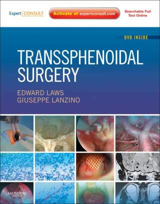 Cover image: Transsphenoidal Surgery - Electronic 1st edition 9781416002925