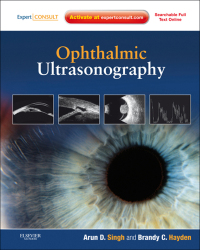 表紙画像: Ophthalmic Ultrasonography 9781437726367
