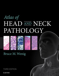 Titelbild: Atlas of Head and Neck Pathology 3rd edition 9781455733828