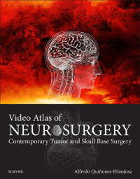 Cover image: Video Atlas of Neurosurgery 9780323261494