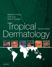 Cover image: Tropical Dermatology 2nd edition 9780323296342