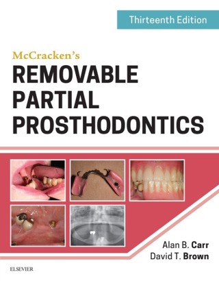 Cover image: McCracken's Removable Partial Prosthodontics 13th edition 9780323339902