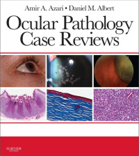 Imagen de portada: Ocular Pathology Case Reviews - Electronic 1st edition 9780323287951