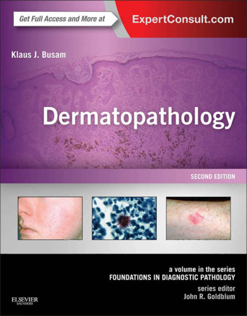 Dermatopathology E-Book: A Volume in the Series: Foundations in Diagnostic Pathology, 2nd Edition - FULL INSTANT DOWNLOAD | PDF DOCX EPUB