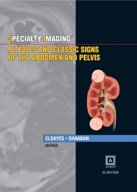 Cover image: Specialty Imaging: Pitfalls and Classic Signs of the Abdomen and Pelvis 9781937242183