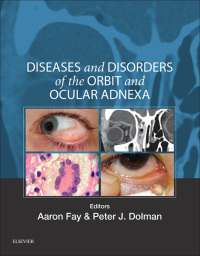 Immagine di copertina: Diseases and Disorders of the Orbit and Ocular Adnexa 9780323377232