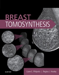 Cover image: Breast Tomosynthesis E-Book 9780323358279