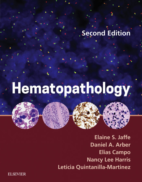 Hematopathology, 2nd  Edition - FULL INSTANT DOWNLOAD | PDF DOCX EPUB