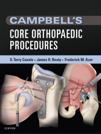 Cover image: Campbell's Core Orthopaedic Procedures 9780323357630