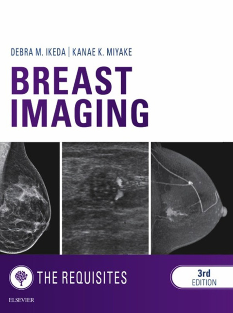 Breast Imaging: The Requisites, 3rd  Edition - FULL INSTANT DOWNLOAD | PDF DOCX EPUB