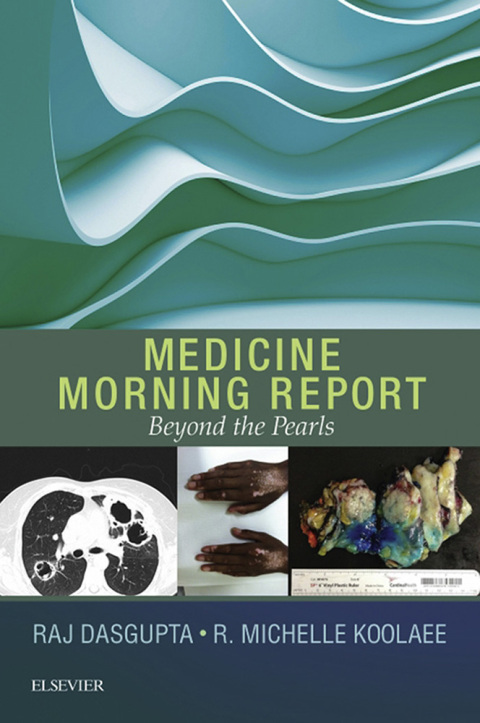 Medicine Morning Report: Beyond the Pearls E-Book - FULL INSTANT DOWNLOAD | PDF DOCX EPUB