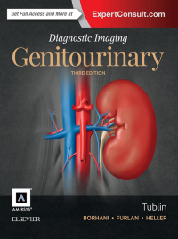 صورة الغلاف: Diagnostic Imaging: Genitourinary 3rd edition 9780323377089