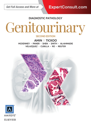 Imagen de portada: Diagnostic Pathology: Genitourinary 2nd edition 9780323377140